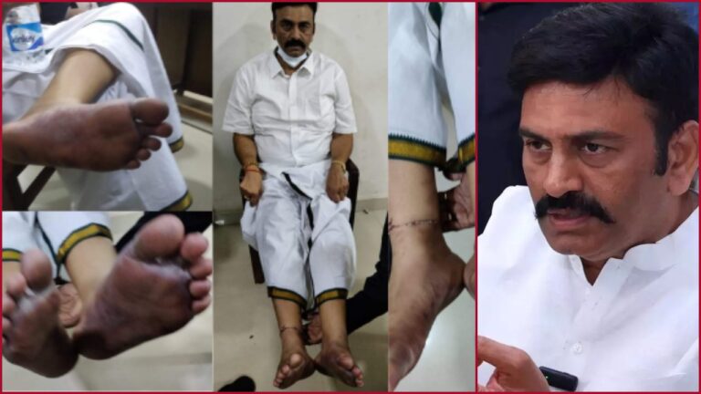 Raghurama Custodial Torture Episode